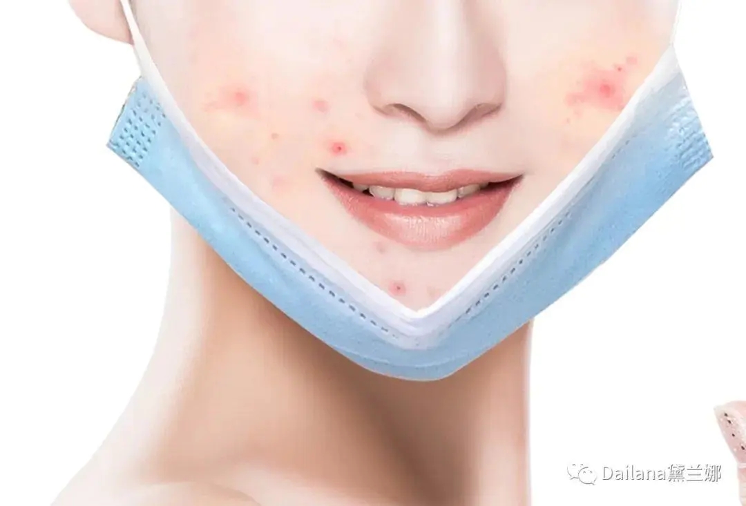 缓减口罩脸 "健康 美丽":黛兰娜"口罩脸"缓减养护方案
