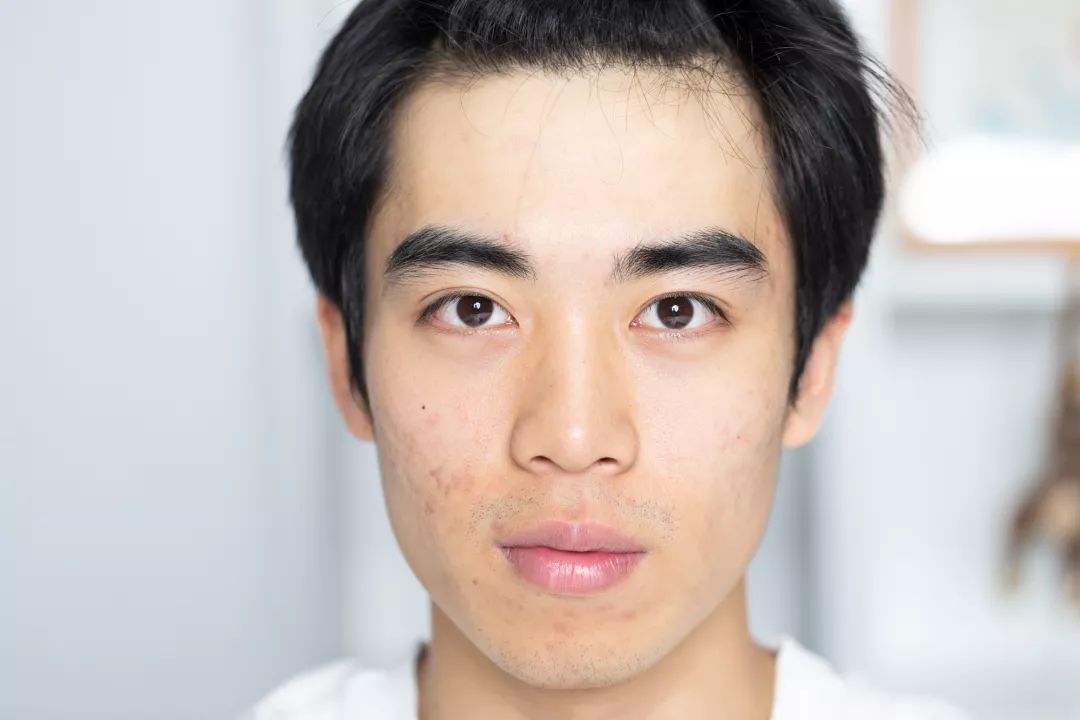 男生如何变干净脸 228bf0e959f247e5a54b3949e9af27dc.jpeg