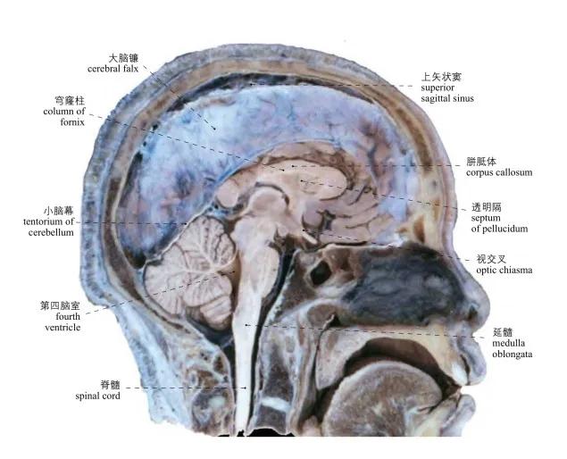 图1-49 头冠状切面 the coronal seetion of the head