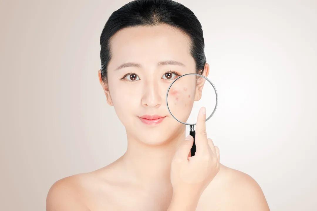 长时间戴口罩皮肤变差如何正确护肤