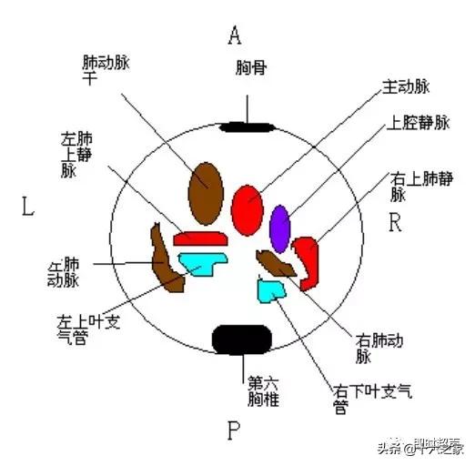 胎儿心脏三血管切面详解