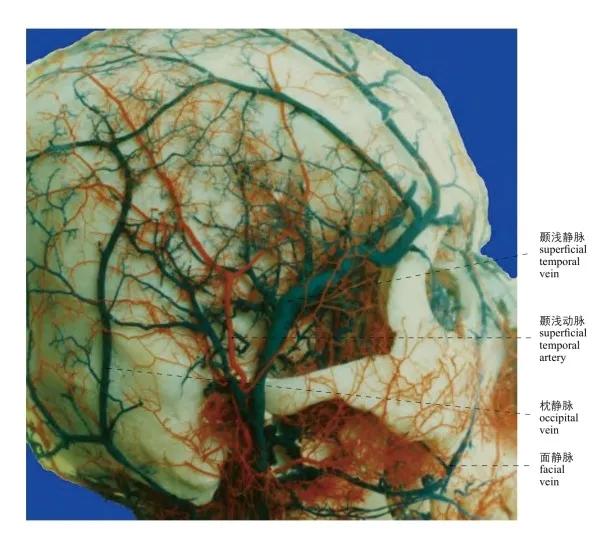 图1-12 头部静脉(侧面观) the veins of the head (lateral aspect)