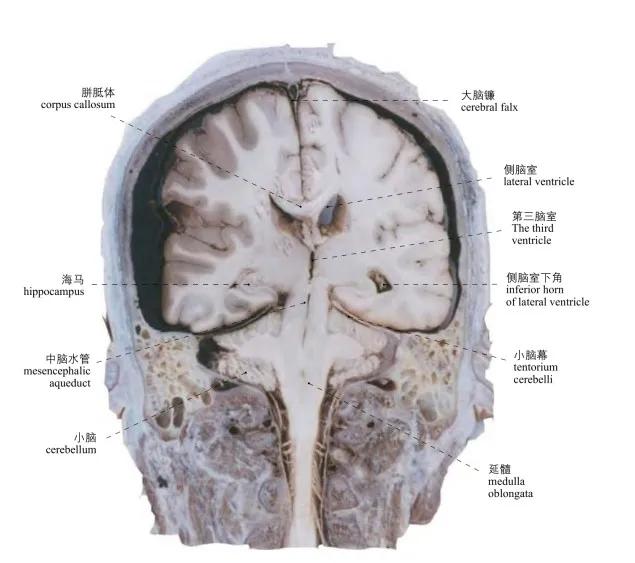 图1-50 头(正中矢状切面) the head (median sagittal section )