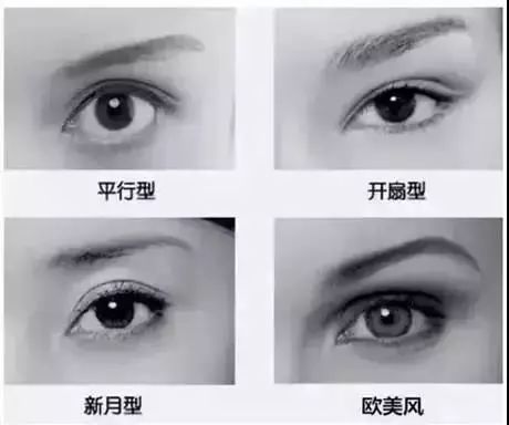 为什么有人动了眼睛还是丑?