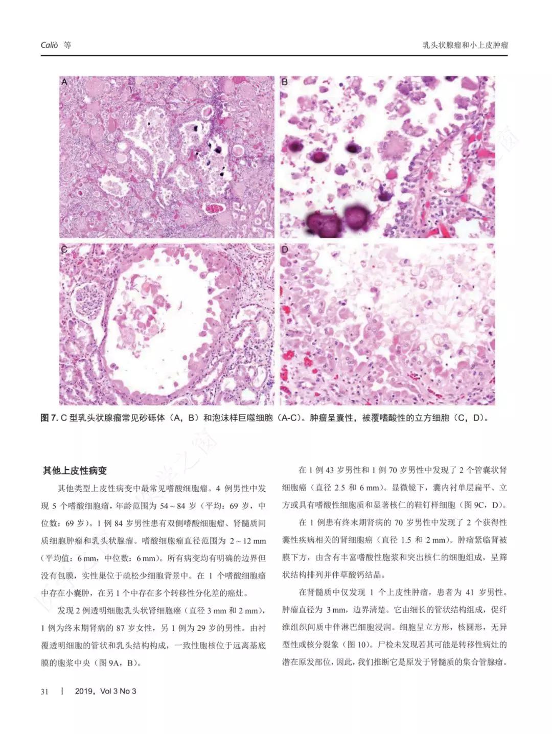 对来自402例未经筛选的尸体解剖肾脏标本每间隔1至2mm进行切片