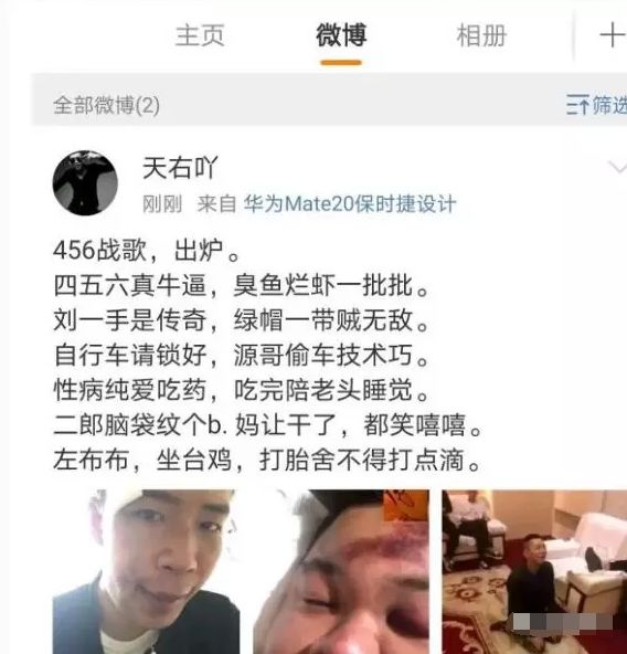 王小源下跪!刘一手一脸血!456真牛b,臭鱼烂虾一批批!300万!