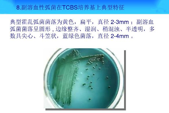 ppt图解丨常见微生物菌落形态