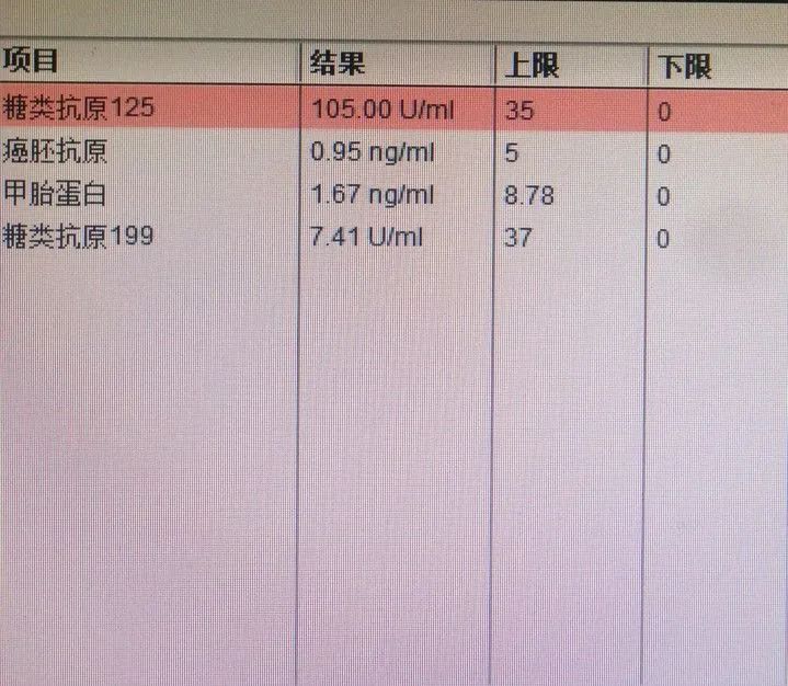 张学军副主任医师神经内镜下经scita切除松果体肿瘤