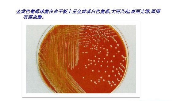 ppt图解丨常见微生物菌落形态