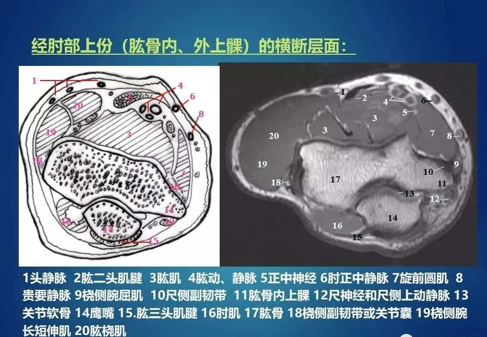 上肢断层解剖及影像