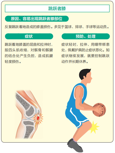 全身肌腱痛怎么办