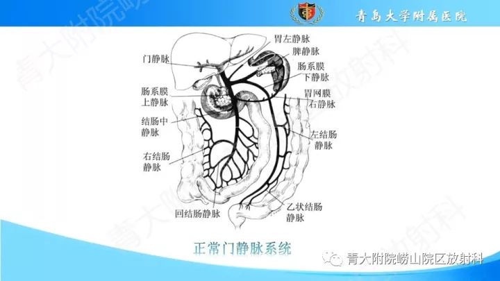 门静脉解剖变异及常见病变影像表现