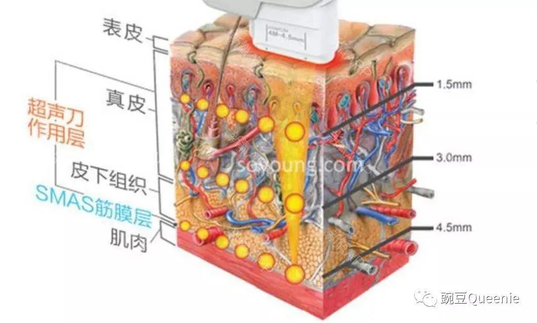 的面部结构:最内层是骨骼,然后是肌肉,肌肉上面是筋膜层,再上面是脂肪