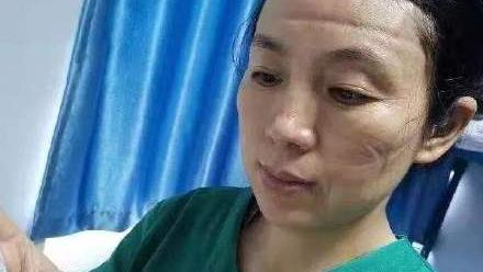 戴眼镜怎么戴口罩不勒 db9788ee918b4524b60ae689bc8a5152.jpeg
