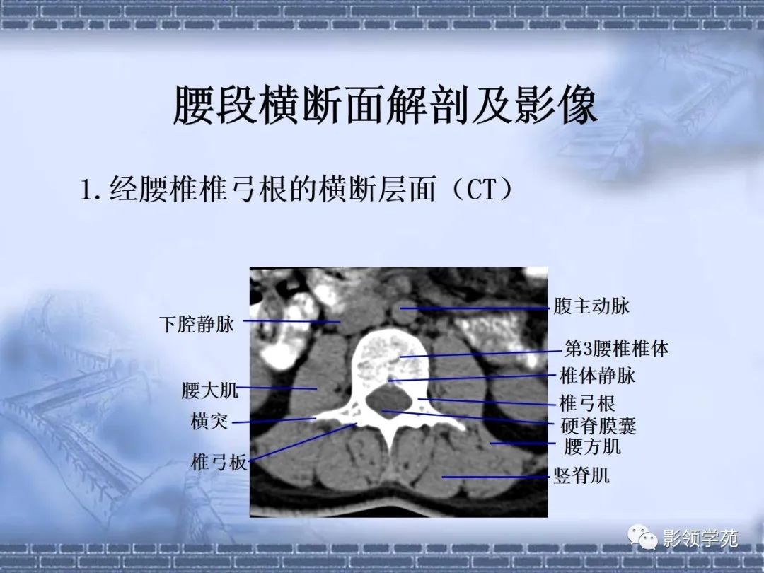 颈椎,腰椎ct常见病变