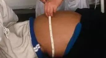 肚子腹水是怎么回事 c3d290974baf49d689587e0b88fb5c18.jpeg