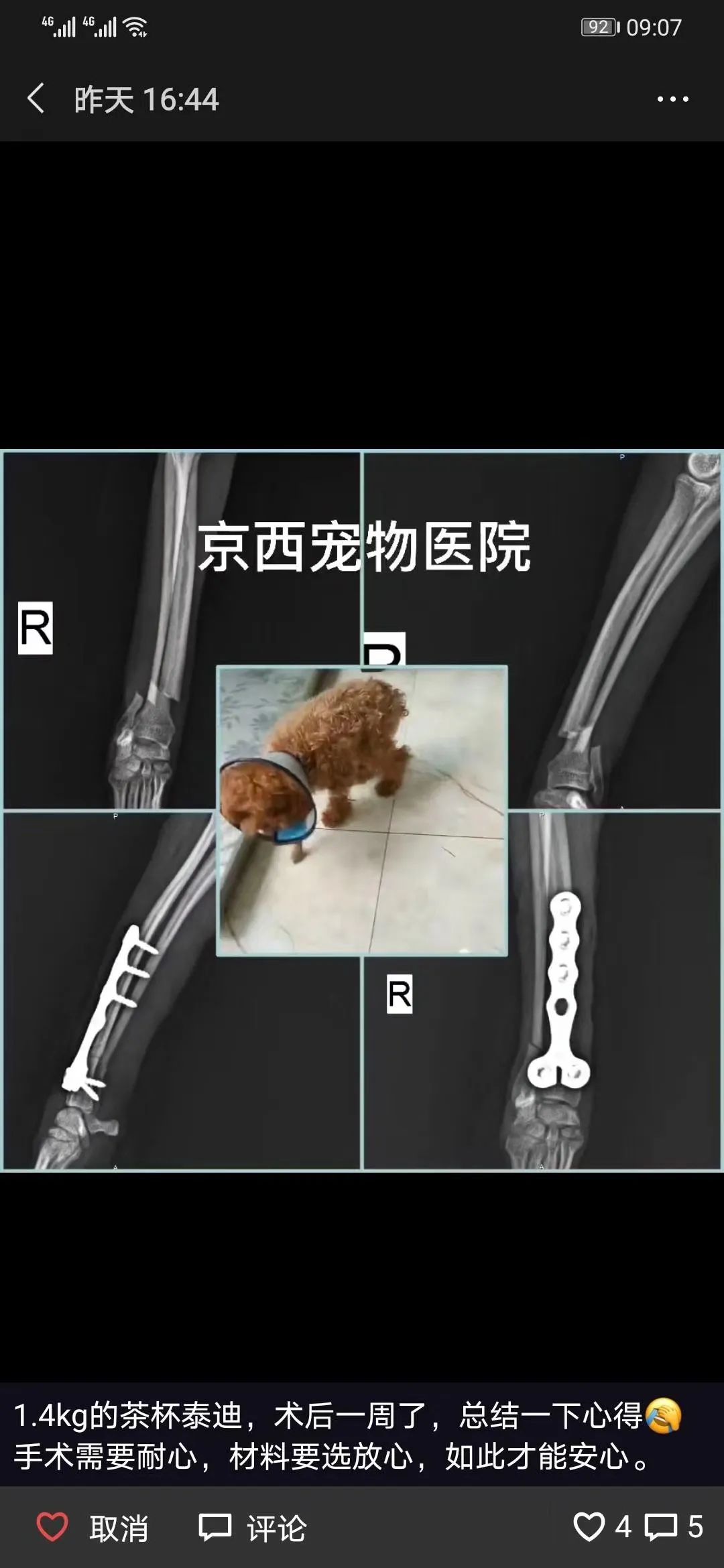 病例分享泰迪右侧桡尺骨远端骨折prclt型板临床病例分享