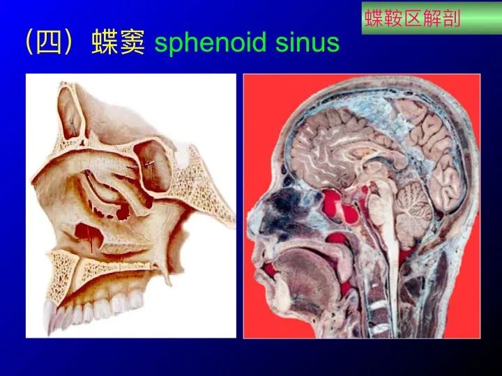 实用课件鞍区解剖资料