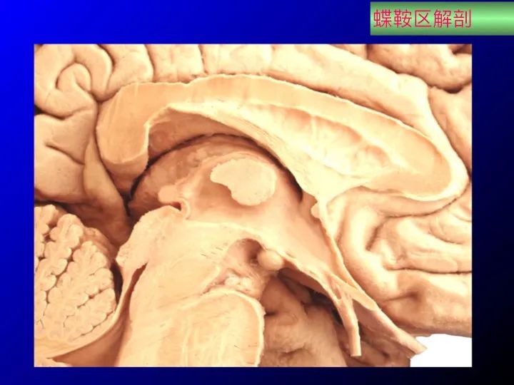 实用课件鞍区解剖资料