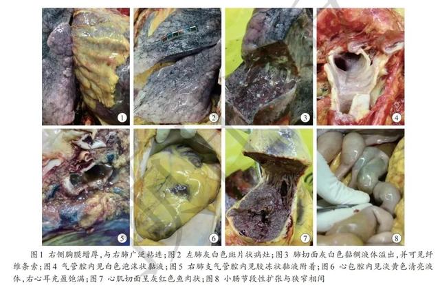 首个新冠肺炎逝者遗体解剖报告公布,有这些重大发现!