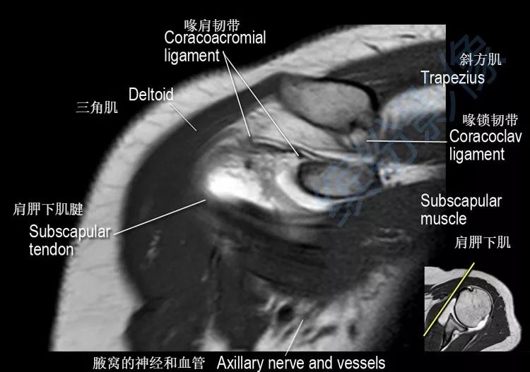 肩关节斜冠状面mr断层解剖