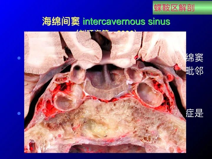 实用课件鞍区解剖资料