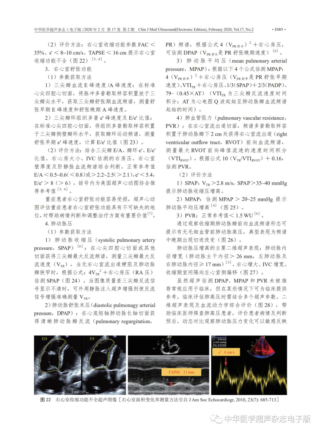 专家建议 | 新型冠状病毒肺炎床旁超声心动图检查及远程诊断实施建议