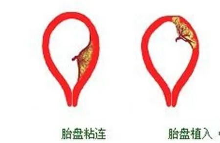 遵义妇科医院好不好