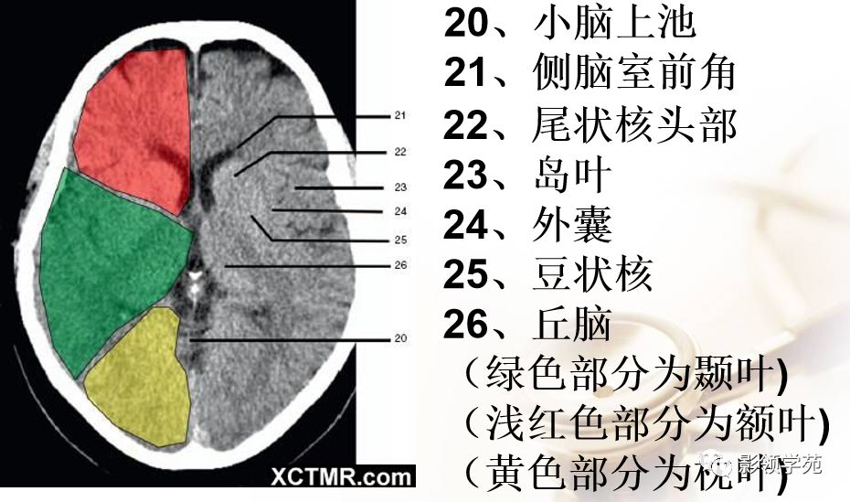 脑实质ct断层解剖