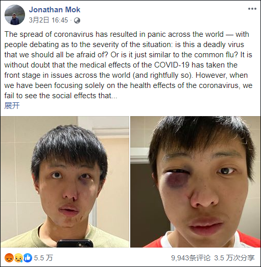 “别把新冠病毒带进来”新加坡留学生在伦敦街头被暴打