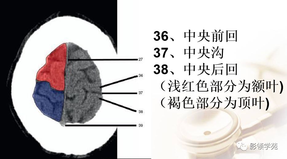 脑实质ct断层解剖_白质