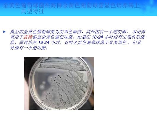 【资料】常见微生物菌落形态