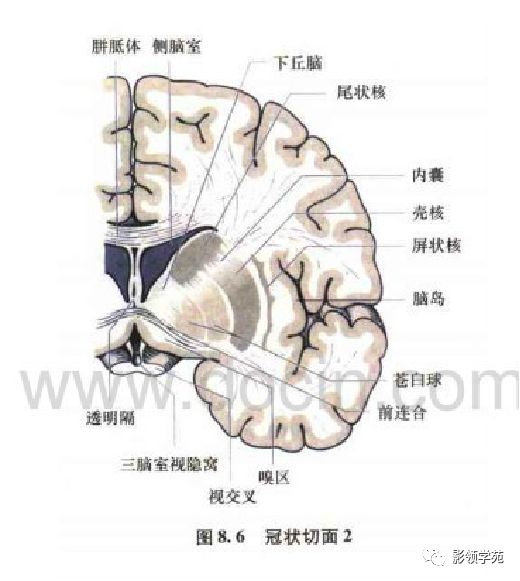 脑实质ct断层解剖