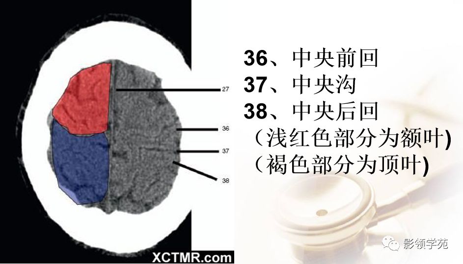 脑实质ct断层解剖_白质