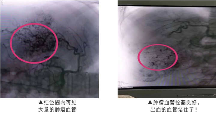 人身体里有多少血量 f160f356db1e478f9aad8f9efa4f27f7.png