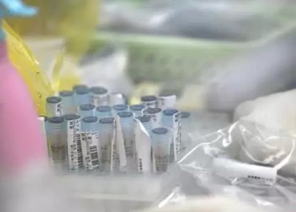 肺炎人口结构_新冠肺炎病毒结构(3)