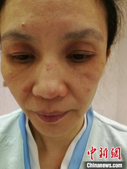 江西人口罩_江西人(2)