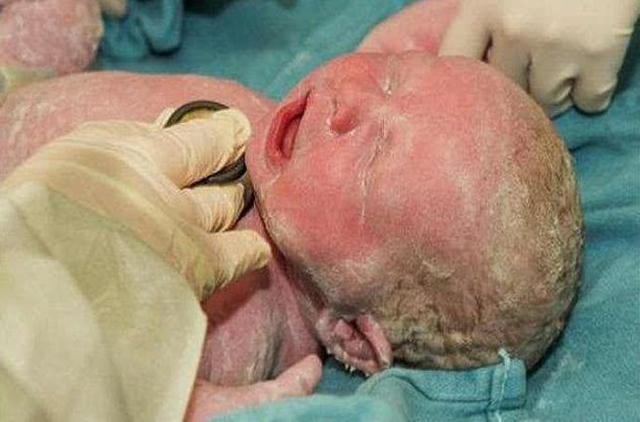 刚出生的宝宝身上裹着“奶油”，妈妈看后万分焦急，医生却连忙道：恭喜了