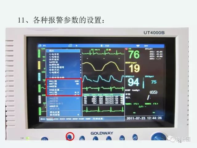 心电监护仪的操作及注意事项详细又实用视频ppt