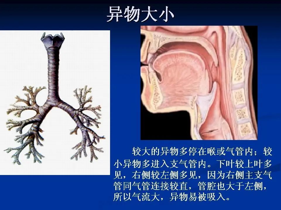 儿童气管及支气管非金属异物影像学评价