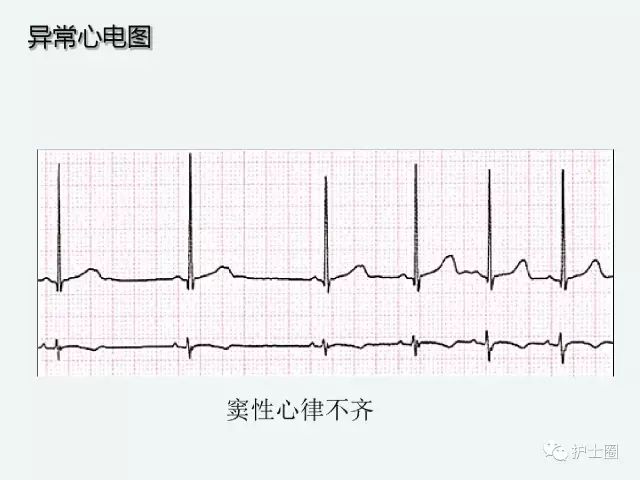 25ffd8e31dcb477db80e5431cb900084.jpeg