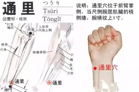 网球肘的症状位置 c242dd57593f423aa273f02ce82504c6.jpeg