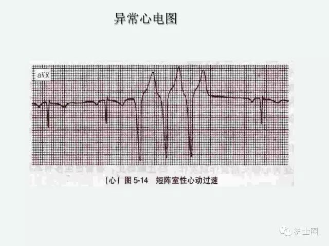 c5501a26983f45afa2b895ec0ecc17ae.jpeg