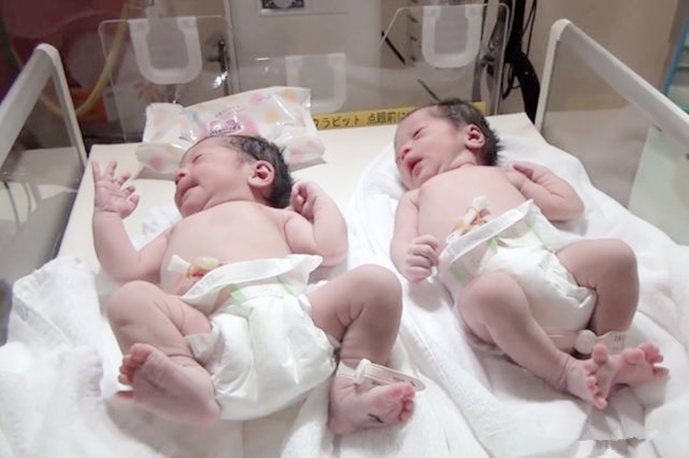 几个月可以分辨出双胞胎 c94723468dcc4bc8b497bda789d30d64.jpeg