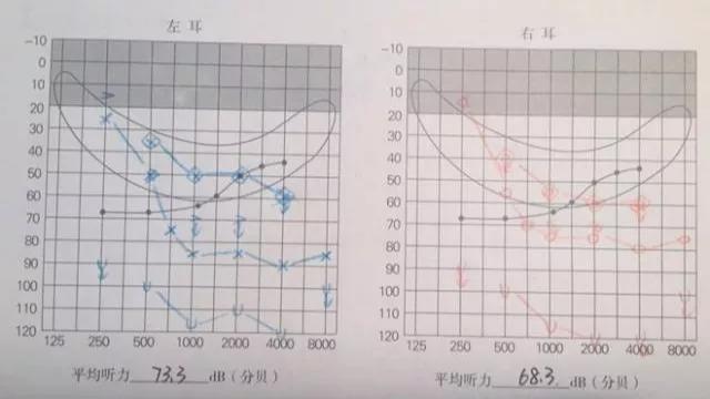 f89a8d98f1634bdeb6d92f748881839f.jpeg