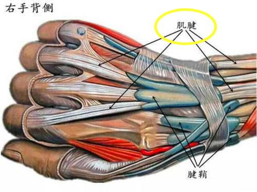 肌腱囊肿怎么办