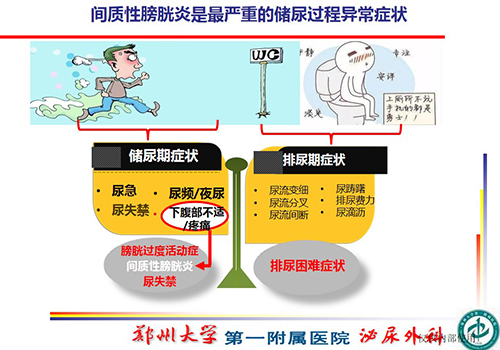 神经调控之家对话王庆伟因下腹部疼痛患上间质性膀胱炎应该如何治疗