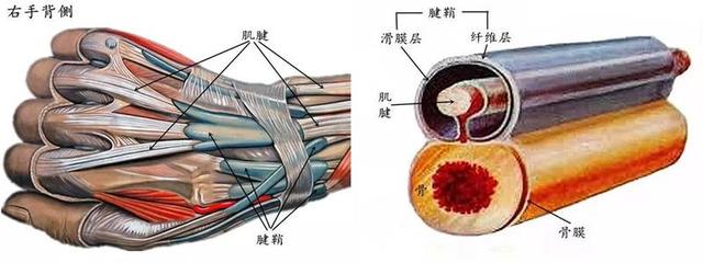 肌腱囊肿怎么办