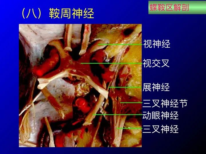 【推荐】鞍区应用解剖 断层解剖图谱