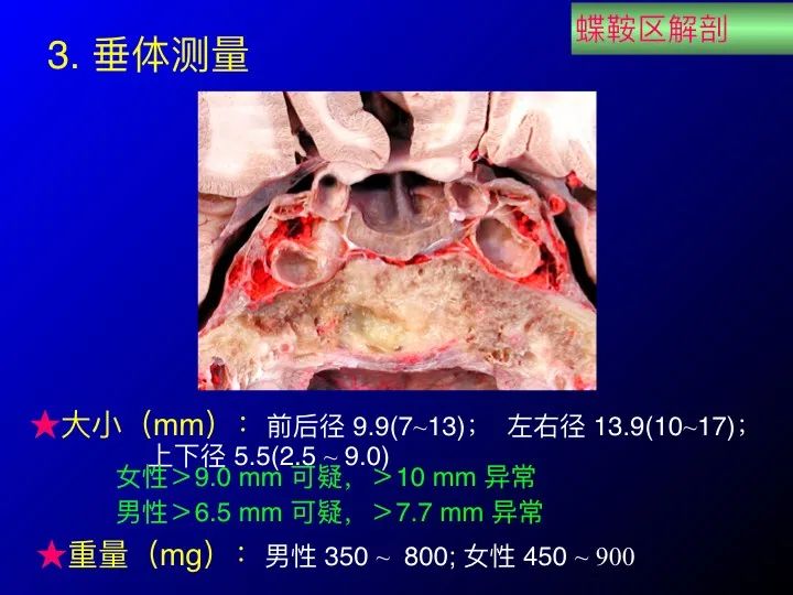 【推荐】鞍区应用解剖 断层解剖图谱